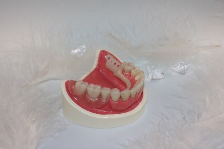 Zahnersatz: Viele Menschen müssen mit einem Kredit für Zahnersatz neue Zähne finanzieren